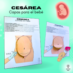Cesárea - Capas hasta el bebé (Español)